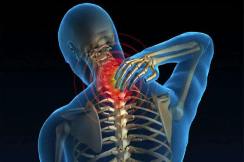 Pain in the cervical spine