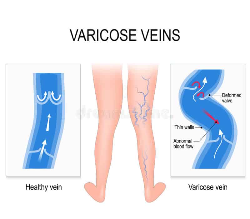 How does venous return occur