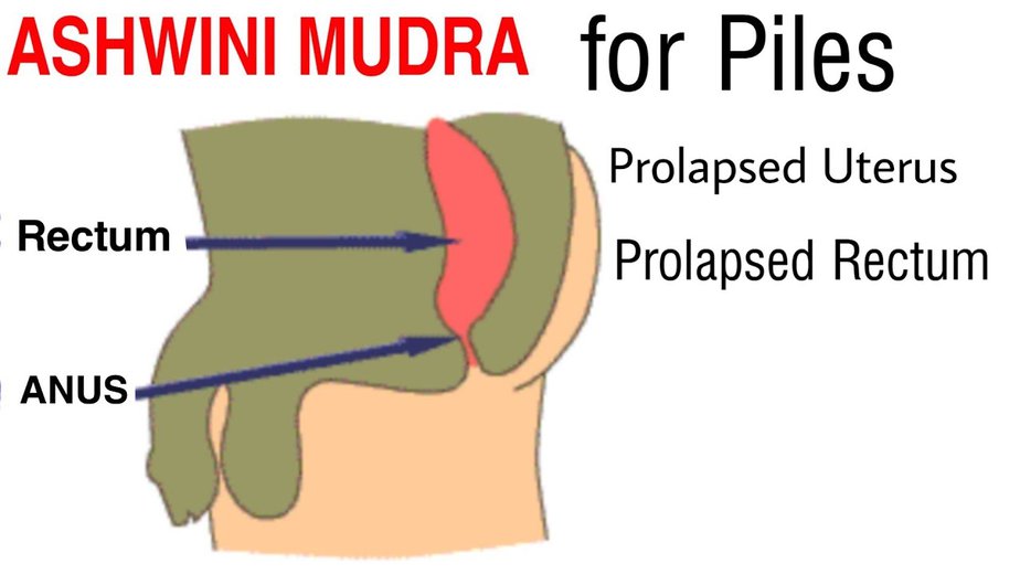 Ashwini Mudra for Piles
